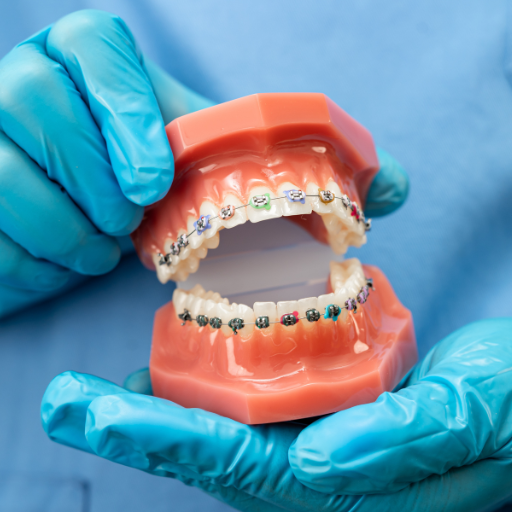 protesis dental siendo sujetada